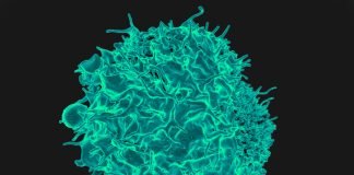 Limfocite T Killer, celule care consolideaza sistemul imunitar si ucid celulele canceroase Limfocite T Killer, celule care consolideaza sistemul imunitar si ucid celulele canceroase