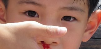 Primul ajutor in cazul sangerarii din nas Primul ajutor in cazul sangerarii din nas