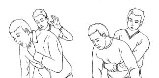 Cum acorzi primul ajutor in caz de sufocare prin asfixiere mecanica