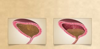 Ce inseamna incontinenta urinara la barbati si cum se poate trata acest simptom