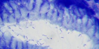 Helicobacter pylori - microbul vinovat de aparitia ulcerului si gastritei