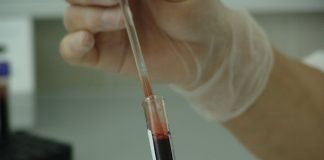 Stiai ca un om are aproximativ 5 litri de sange in sistemul circulator