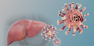 Stiati ca aproximativ 2 milioane de romani sufera de hepatita B, C si D