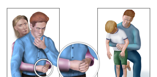 Care sunt cauzele obstrucției căilor respiratorii pe care le putem experimenta? Care sunt cauzele obstrucției căilor respiratorii pe care le putem experimenta