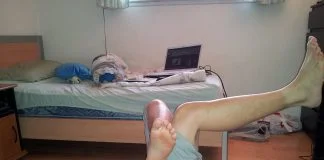 Cum apare și cum tratăm sindromul piriformis