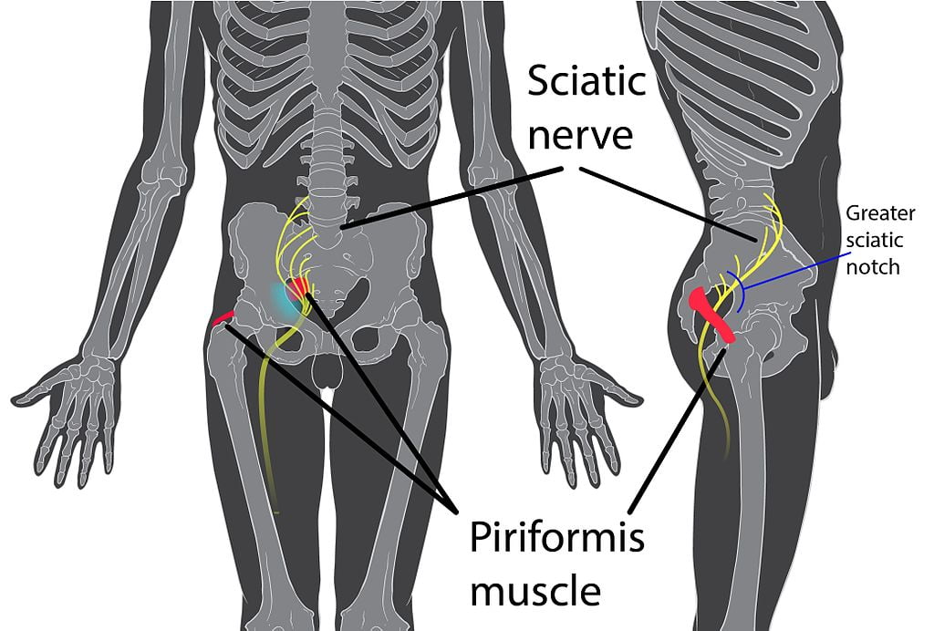 piriforma