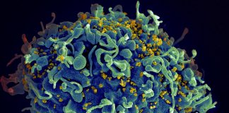 Care sunt modalitățile de transmitere în cazul virusului HIV