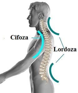 Cifoza și lordoza, curburi ale coloanei vertebrale