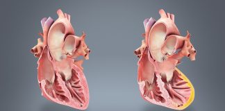 7 semne insesizabile ale infarctului miocardic – Află care sunt semnele pe care nu trebuie să le neglijezi 7 semne insesizabile ale infarctului miocardic – Află care sunt semnele pe care nu trebuie să le neglijezi