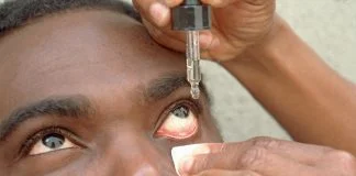 Iată ce trebuie să faci în cazul în care te dor ochii de la curent