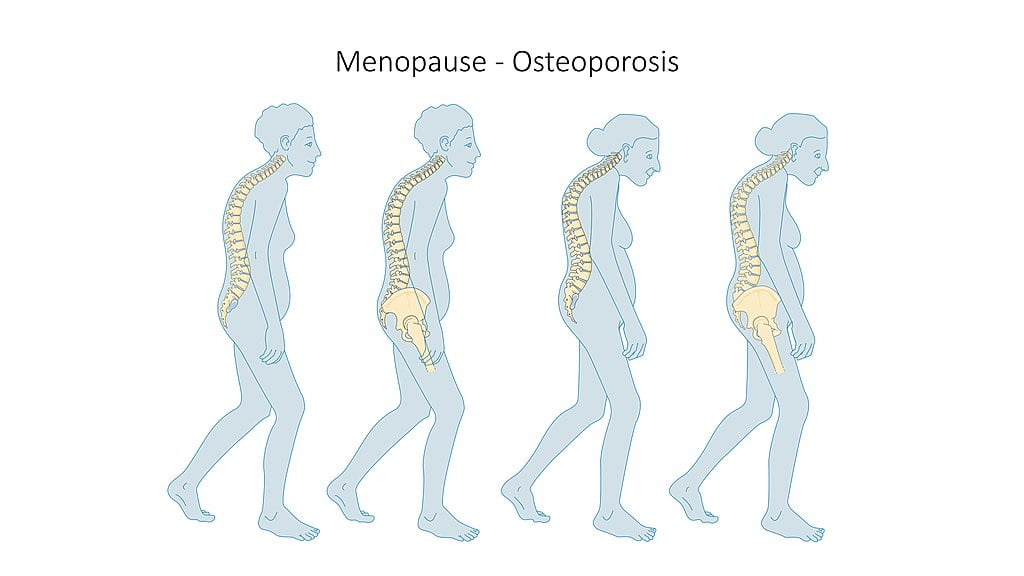 menopauza