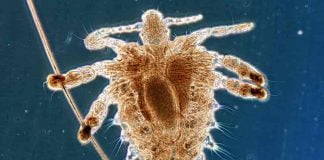 Care sunt remediile naturale pentru o infestație cu păduchi, numită și pediculoză? Care sunt remediile naturale pentru o infestație cu păduchi, numită și pediculoză
