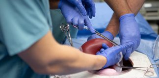 Probleme legate de histerectomie – Care sunt efectele secundare ale îndepărtării uterului? Probleme legate de histerectomie – Care sunt efectele secundare ale îndepărtării uterului