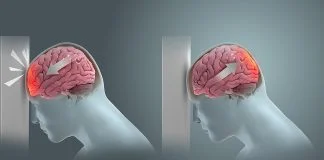 Măsuri de prim ajutor în caz de traumatisme craniene – Tu știi ce trebuie să faci