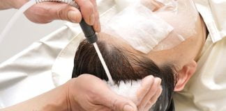 Metode de tratament ale alopeciei androgenice – Iată cum poți trata și preveni căderea părului Metode de tratament ale alopeciei androgenice – Iată cum poți trata și preveni căderea părului