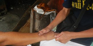 Tratament eficient de reflexologie asupra mâinilor