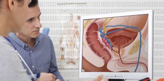 Legătura dintre cancerul de prostată și alimentația de origine animală bogată în produse lactate Legătura dintre cancerul de prostată și alimentația de origine animală bogată în produse lactate