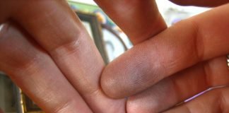 Simptomele resimțite în cazul intoxicației cu plumb și remediile naturiste de tratament Simptomele resimțite în cazul intoxicației cu plumb și remediile naturiste de tratamentSimptomele resimțite în cazul intoxicației cu plumb și remediile naturiste de tratament
