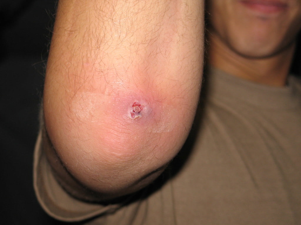 muscatura de paianjen