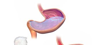 Care sunt metodele prin care medicul sau specialistul pune diagnosticul în cazul bolii de reflux gastroesofagian