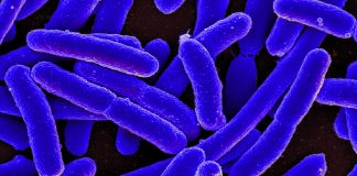 Sindromul hemolitic uremic, cauza insuficienței renale acute la copii