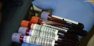 Ce analize se fac atunci când te doare pancreasul Află ce boli se pot depista prin explorarea funcţională a pancreasului
