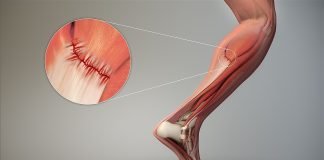 Dureri care nu este bine să le neglijaţi – Crampele musculare la gambe