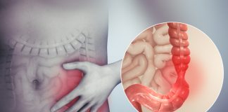 Știați că mai mult de 25% din populație suferă de colon iritabil Iată ce trebuie să știi despre această afecțiune