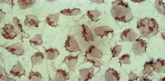 Trichomoniaza intestinală – Simptome și tratament