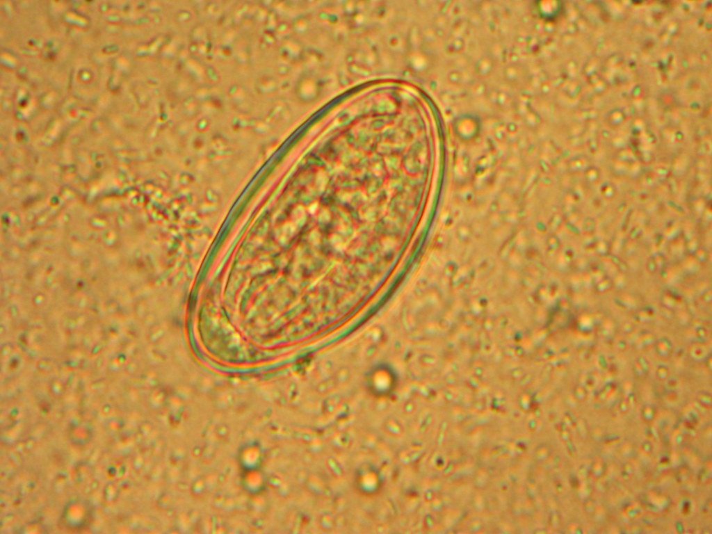 Enterobius vermicularis