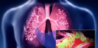 Bolile aparatului respirator și simptomele lor – metode de tratament
