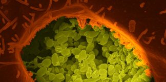 Febra Q – febra de Queensland sau rickettsioza pulmonară