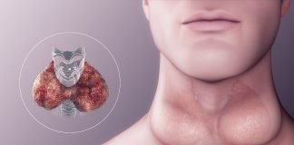 Hipotiroida și hipertiroida – Ce efect au hormonii toroidieni asupra organismului și a stării de sănătate Hipotiroida și hipertiroida – Ce efect au hormonii toroidieni asupra organismului și a stării de sănătate
