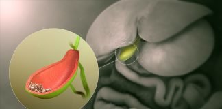 8 simptome care anunță afecțiunile colecistului – Când este necesar să te operezi? 8 simptome care anunță afecțiunile colecistului – Când este necesar să te operezi
