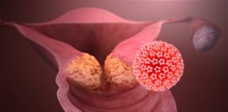 Mai mult de jumătate dintre bărbați sunt purtatori ai virusului HPV – Cum se transmite infecția cu HPV și care este riscul ei de cancer