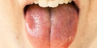 Știați că saliva ajută la dezinfectarea rănilor și omoară bacteriile