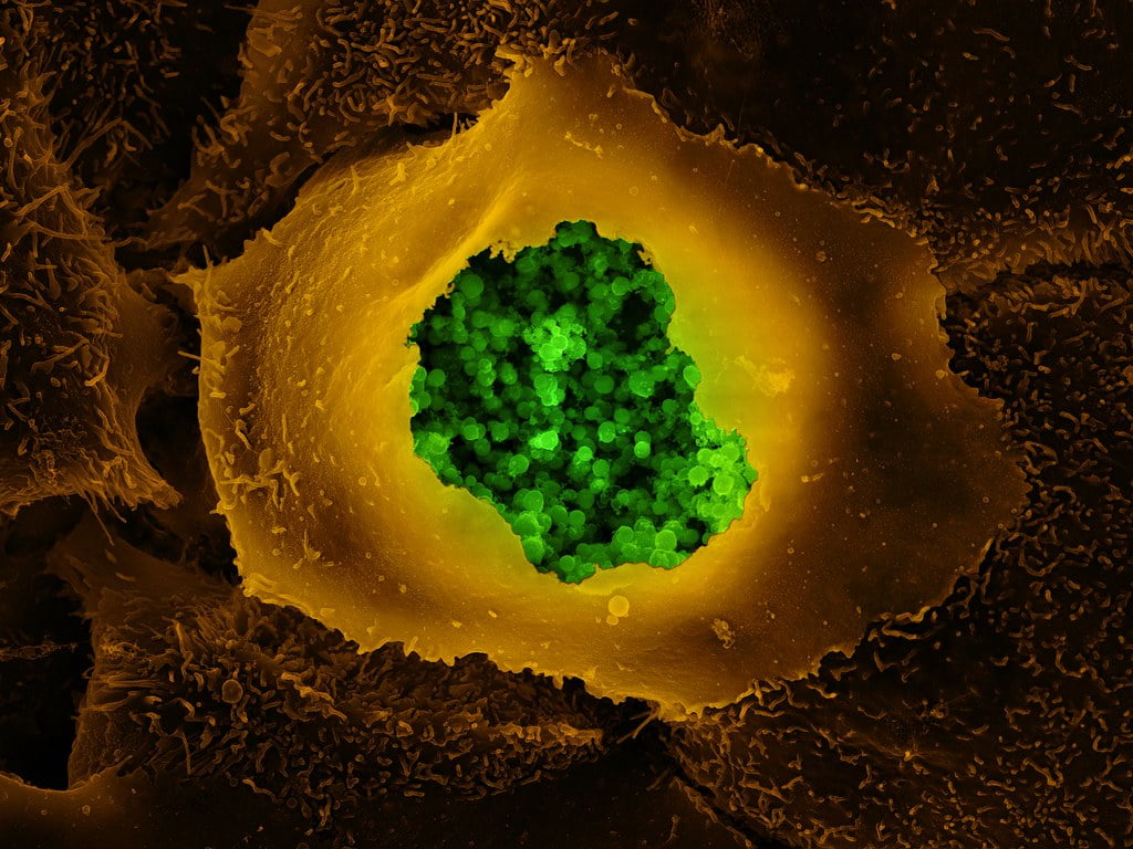 Infecția cu Chlamydia