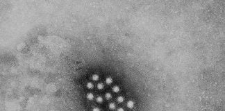 Hepatitis a virus hav an rna virus that can survive up to a mont