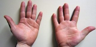 Descoperă care sunt cele mai eficiente plante și nutrienți pentru tratamentul leucodermei sau vitiligo