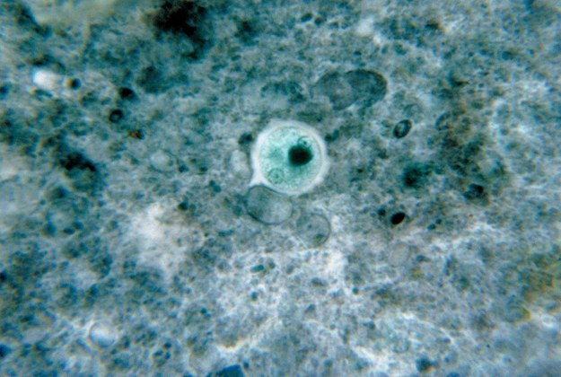 Entamoeba histolytica, Foto: buzzfeed.com