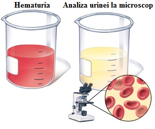 Instrucțiuni recoltare - teste urina din 24 ore - Synevo