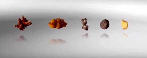 Pietre la rinichi de diferite forme și dimensiuni