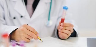 Trigliceridele – factor de risc pentru accidentul vascular cerebral și afecțiunile cardiace 1-analize-de-sange-trigliceride