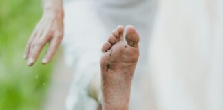 De ce reapare ciuperca piciorului? Cum o poți combate corect?